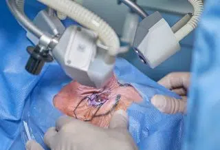 Pourquoi avoir recours à la chirurgie réfractive ?